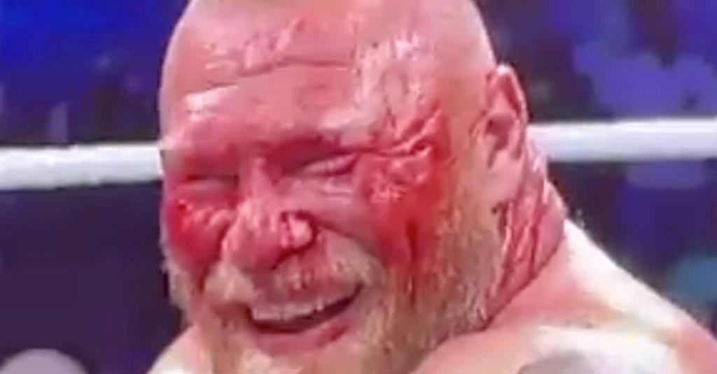 wwe-brock-lesnar-blood-msg.jpg