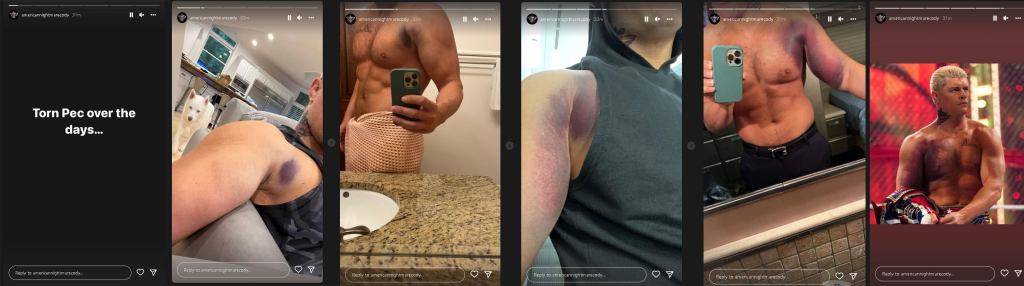 cody-rhodes-bruise-progression.jpg