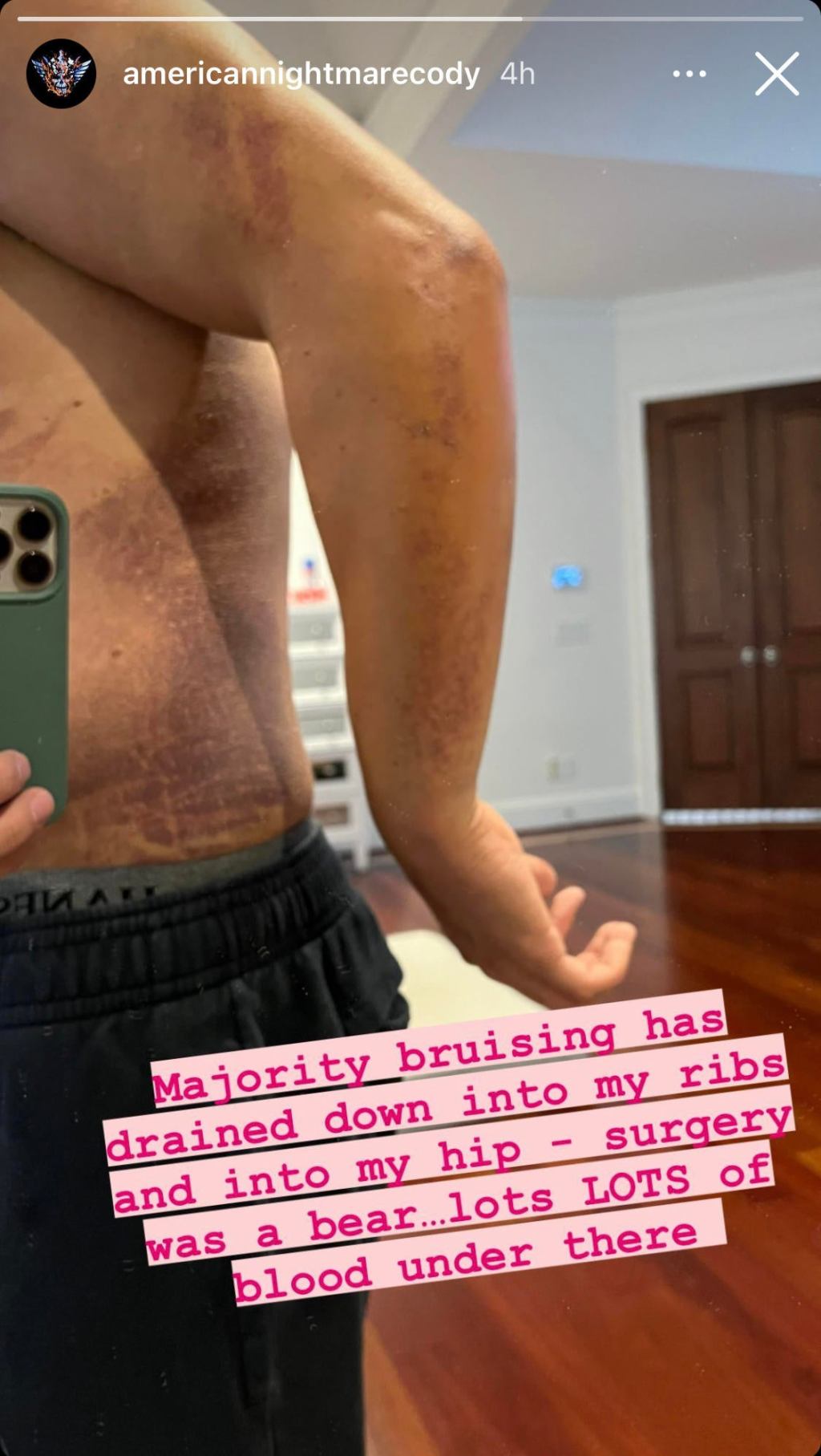 wwe-cody-rhodes-injury-instagram.jpg