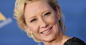 Actress Anne Heche Reportedly Severely Burned After Car Crash