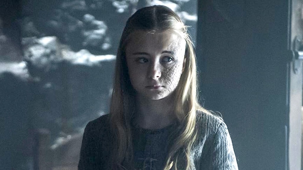 Kerry Ingram como Shireen Baratheon en Game of Thrones