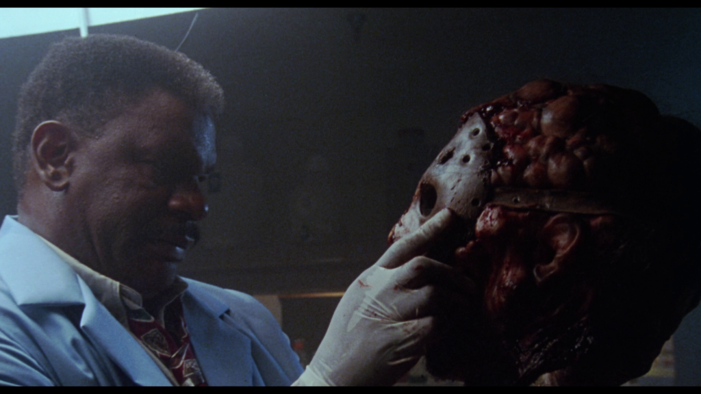The coroner holds the head of Jason Voorhees.